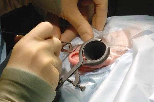 Vá màng nhĩ là phương pháp cấy ghép mô ở bộ phận khác vào màng nhĩ, nhằm phục hồi khả năng nghe